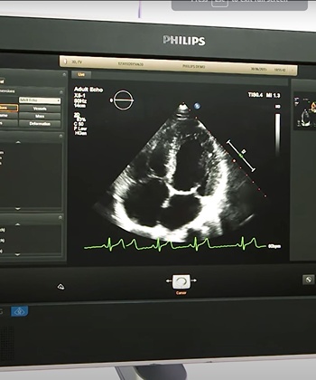 Echocardiography being done at Beats Heart Clinic Nagpur